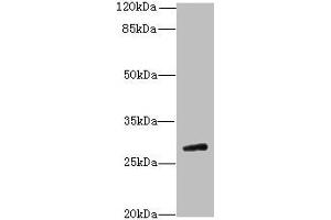 Western blot All lanes: TBC1D26 antibody at 3 μg/mL + Mouse liver tissue Secondary Goat polyclonal to rabbit IgG at 1/10000 dilution Predicted band size: 29, 25, 10 kDa Observed band size: 29 kDa (TBC1D26 抗体  (AA 1-250))