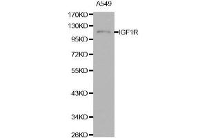 Western blot analysis of extracts of A549 cells using IGF1R antibody. (IGF1R 抗体  (AA 660-760))