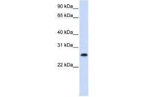 PHF19 antibody used at 0. (PHF19 抗体  (C-Term))