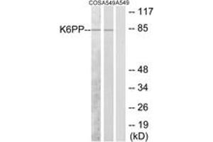 Western Blotting (WB) image for anti-phosphofructokinase, Platelet (PFKP) (AA 341-390) antibody (ABIN2889539) (PFKP 抗体  (AA 341-390))