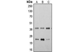 Western blot analysis of STING expression in K562 (A), THP1 (B), HeLa (C) whole cell lysates. (STING/TMEM173 抗体  (C-Term))