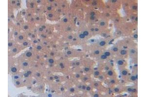 Immunohistochemistry (IHC) image for anti-Agouti Related Protein Homolog (Mouse) (AGRP) (AA 21-131) antibody (ABIN7433411)