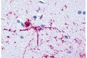 Anti-GRM8 / MGLUR8 antibody  ABIN1048945 IHC staining of human brain, neurons and glia. (GRM8 抗体  (N-Term))