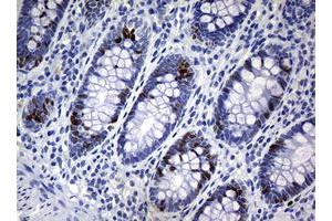 Image no. 4 for anti-Antigen Identified By Monoclonal Antibody Ki-67 (MKI67) (AA 1160-1493) antibody (ABIN1490857) (Ki-67 抗体  (AA 1160-1493))