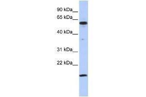 Human Jurkat; WB Suggested Anti-TRIP10 Antibody Titration: 0. (TRIP10 抗体  (Middle Region))