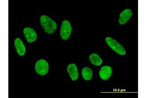 Immunofluorescence (IF) image for anti-F-Box Protein 11 (FBXO11) (AA 744-843) antibody (ABIN566432)
