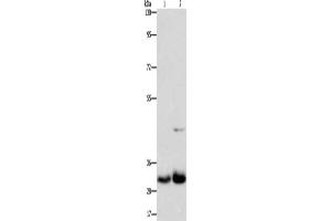 Gel: 8 % SDS-PAGE, Lysate: 40 μg, Lane 1-2: Lovo cells, PC3 cells, Primary antibody: ABIN7130253(MPG Antibody) at dilution 1/950, Secondary antibody: Goat anti rabbit IgG at 1/8000 dilution, Exposure time: 1 minute (MPG 抗体)