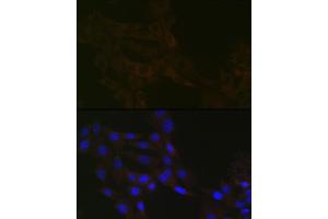 Immunofluorescence (IF) image for anti-Tubulin, gamma 1 (TUBG1) antibody (ABIN7271052)