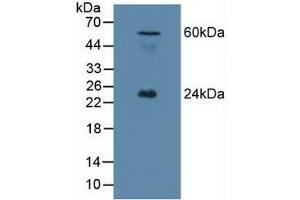 Detection of EFNA1 in Mouse Testis Tissue using Polyclonal Antibody to Ephrin A1 (EFNA1) (Ephrin A1 抗体  (AA 19-182))