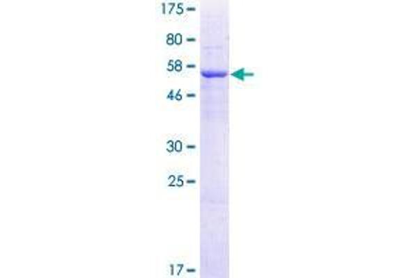 TRMT61A Protein (AA 1-289) (GST tag)