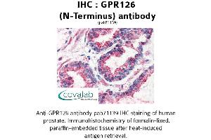 Image no. 2 for anti-G Protein-Coupled Receptor 126 (GPR126) (N-Term) antibody (ABIN1734925) (G Protein-Coupled Receptor 126 抗体  (N-Term))