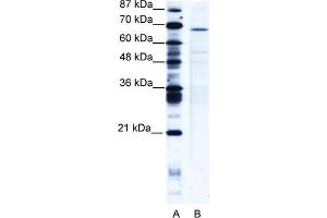 WB Suggested Anti-PSIP1 Antibody   Titration: 5 ug/ml   Positive Control: Jurkat Whole Cell PSIP1 is strongly supported by BioGPS gene expression data to be expressed in Human Jurkat cells (PSIP1 抗体  (Middle Region))