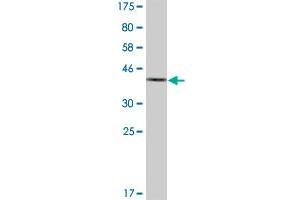 Western Blot detection against Immunogen (36. (AKR1C2 抗体  (AA 224-323))