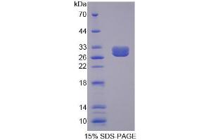 SDS-PAGE analysis of Mouse BCR Protein. (BCR 蛋白)