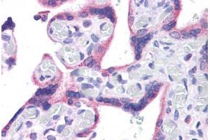 Human Placenta: Formalin-Fixed, Paraffin-Embedded (FFPE) (WT1 抗体  (C-Term))