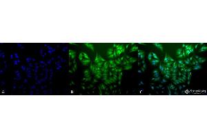 Immunocytochemistry/Immunofluorescence analysis using Mouse Anti-Ubiquitin Monoclonal Antibody, Clone 5B9-B3 . (Ubiquitin 抗体  (FITC))