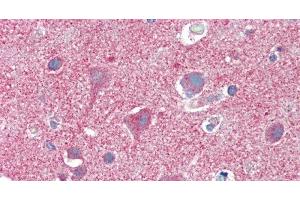 Immunohistochemistry (Paraffin-embedded Sections) (IHC (p)) image for anti-Clathrin Heavy Chain (CLTC) antibody (ABIN7238828)