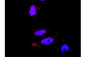 Proximity Ligation Analysis of protein-protein interactions between MAPK8 and RHOA. (RHOA 抗体  (AA 1-193))