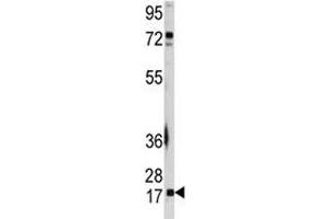 Western blot analysis of UBE2I antibody and A2058 lysate. (UBE2I 抗体  (AA 1-30))