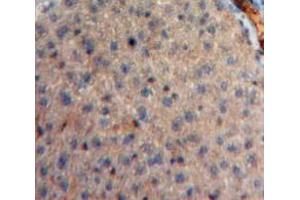 Used in DAB staining on fromalin fixed paraffin-embedded Liver tissue (Neuregulin 4 抗体  (AA 1-62))