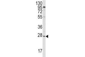 Western blot analysis of APOA1 antibody and HepG2 lysate. (APOA1 抗体  (AA 10-37))