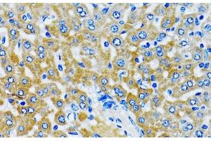 Immunohistochemistry of paraffin-embedded Rat liver using HDAC5 Polyclonal Antibody at dilution of 1:100 (40x lens). (HDAC5 抗体)