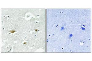 Immunohistochemical analysis of paraffin-embedded human brain tissue using STK39 (Phospho-Ser323) antibody (left)or the same antibody preincubated with blocking peptide (right). (STK39 抗体  (pSer325))