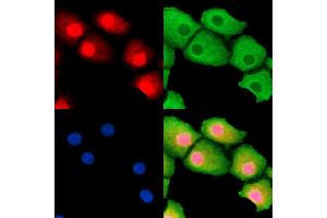ABIN7095306 and ABIN7099363 staining Hela cells by IF/ICC.