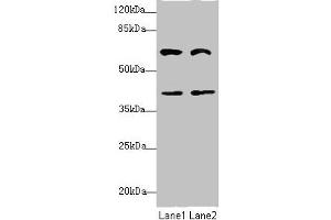 Western blot All lanes: DCP1A antibody at 3. (DCP1A 抗体  (AA 303-582))