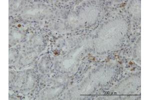 Image no. 3 for anti-Fibrinogen-Like 2 (FGL2) (AA 24-124) antibody (ABIN466173) (FGL2 抗体  (AA 24-124))