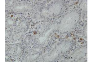 Image no. 3 for anti-Fibrinogen-Like 2 (FGL2) (AA 24-124) antibody (ABIN466173)