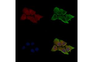 Phospho-CaMKII alpha (Ser331) Antibody staining HepG2 cells(serum starvation treatment) by IF/ICC. (CAMK2A 抗体  (pSer331))