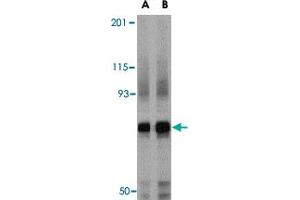 Western blot analysis of NCSTN in mouse brain tissue lysate with NCSTN polyclonal antibody  at (A) 0. (Nicastrin 抗体  (Internal Region))