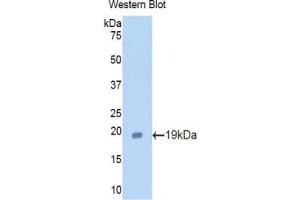 Western blot analysis of the recombinant protein. (Lactoferrin 抗体  (AA 64-193))