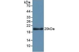 Detection of Recombinant APOL2, Human using Monoclonal Antibody to Apolipoprotein L2 (APOL2) (Apolipoprotein L 2 抗体  (AA 186-337))