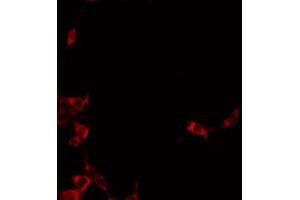ABIN6272341 staining A549 by IF/ICC. (ST14 抗体  (Internal Region))