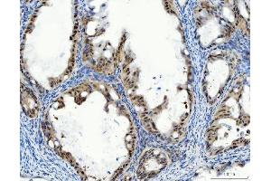 IHC analysis of Aurora A/AURKA using anti-Aurora A/AURKA antibody (ABIN7600751).