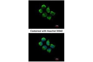 ICC/IF Image Immunofluorescence analysis of methanol-fixed A431, using SNX12, antibody at 1:500 dilution. (SNX12 抗体  (C-Term))