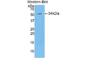 Detection of Recombinant DSG1, Human using Polyclonal Antibody to Desmoglein 1 (DSG1) (Desmoglein 1 抗体  (AA 710-961))