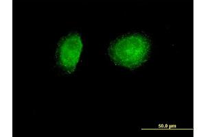 Immunofluorescence of purified MaxPab antibody to SNX1 on HeLa cell. (Sorting Nexin 1 抗体  (AA 1-522))