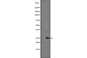 Western Blotting (WB) image for anti-MOB1, Mps One Binder Kinase Activator-Like 1B (MOBKL1B) (Internal Region) antibody (ABIN6259071)