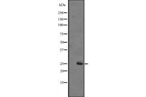Western blot analysis of MOBKL1B expression in A431 whole cell lysate ,The lane on the left is treated with the antigen-specific peptide. (MOB1A 抗体  (Internal Region))