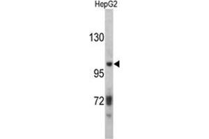 Western blot analysis of ITIH2 antibody (C-term) in HepG2 cell line lysates (35ug/lane). (ITIH2 抗体  (C-Term))