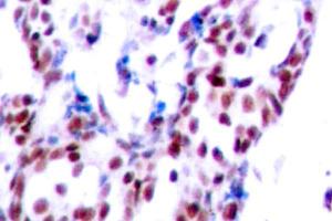 Image no. 2 for anti-Activating Transcription Factor 2 (ATF2) antibody (ABIN265320) (ATF2 抗体)