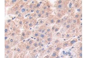 Detection of HLTF in Human Liver Tissue using Polyclonal Antibody to Helicase Like Transcription Factor (HLTF) (HLTF 抗体  (AA 837-996))