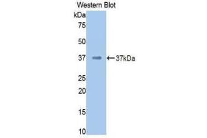 Western Blotting (WB) image for anti-Coagulation Factor II (thrombin) (F2) (AA 325-618) antibody (ABIN3207761) (Prothrombin 抗体  (AA 325-618))