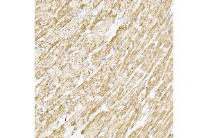 Immunohistochemistry (IHC) image for anti-Transmembrane Protein 173 (TMEM173) (AA 170-379) antibody (ABIN1683049)
