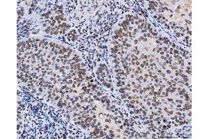 IHC analysis of Lamin A+C/LMNA using anti-Lamin A+C/LMNA antibody (ABIN7601843). (Lamin A/C 抗体  (AA 481-646))