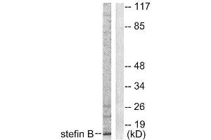 Western Blotting (WB) image for anti-Cystatin B (Stefin B) (CSTB) (Internal Region) antibody (ABIN1848780) (CSTB 抗体  (Internal Region))