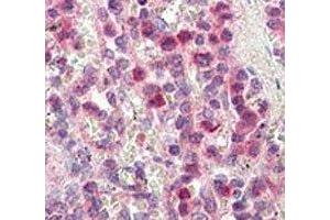 Immunohistochemistry (IHC) image for anti-Matrix Metallopeptidase 9 (Gelatinase B, 92kDa Gelatinase, 92kDa Type IV Collagenase) (MMP9) (AA 644-673) antibody (ABIN3031728)